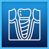 Implantes Dentales